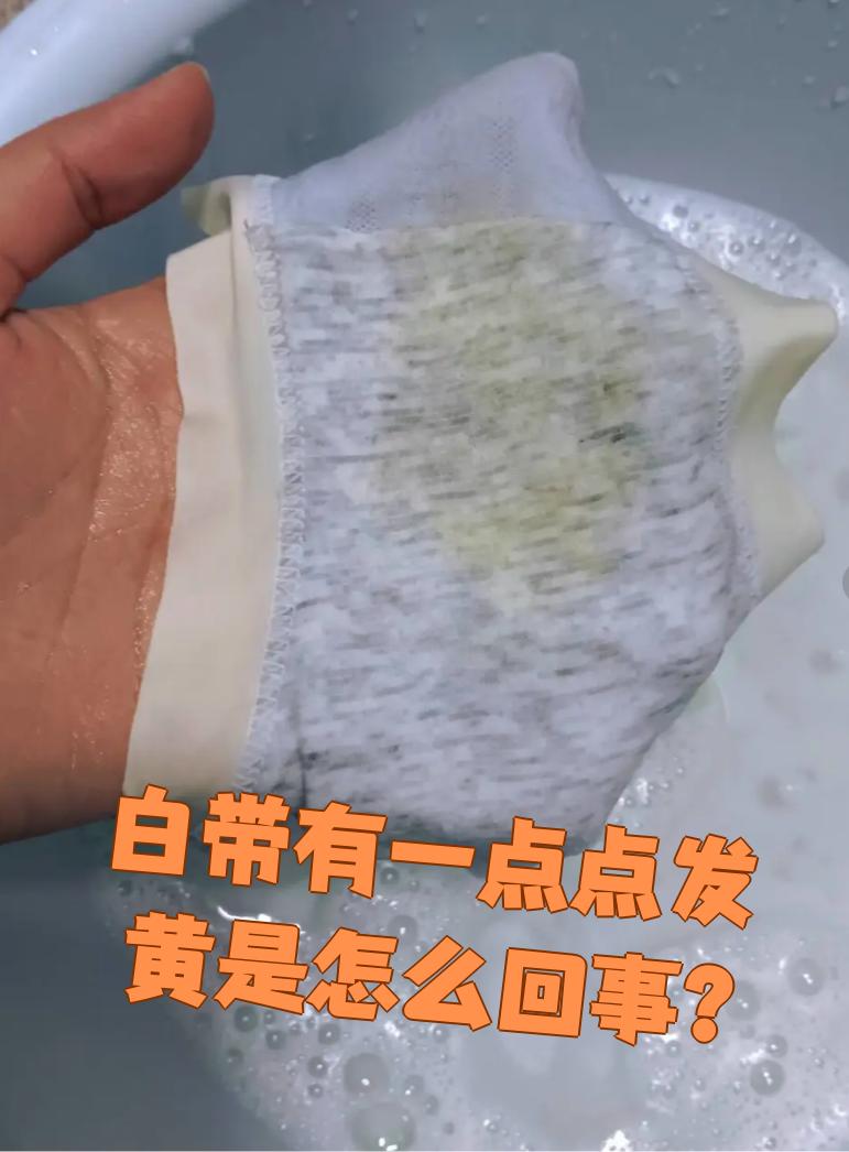 白带多,粘稠发黄怎么回事?