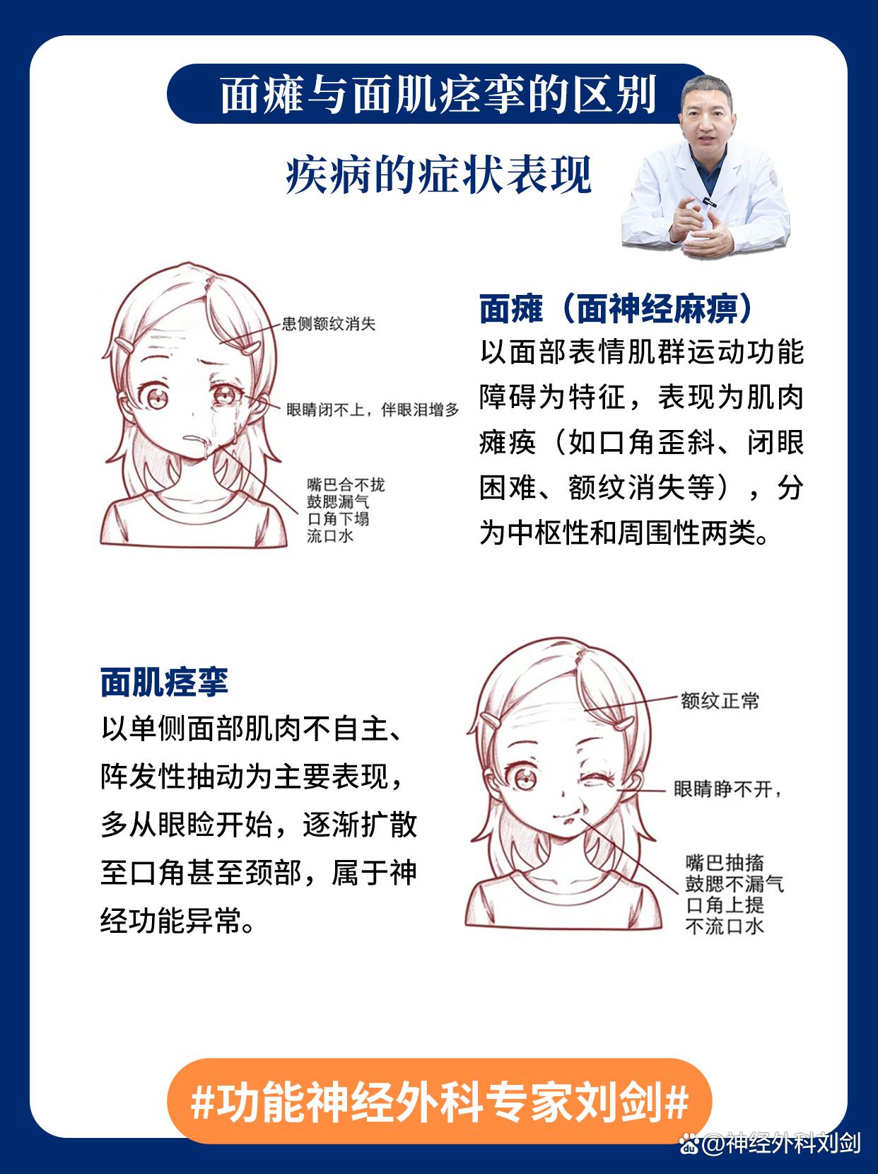 面神经痉挛怎么治疗