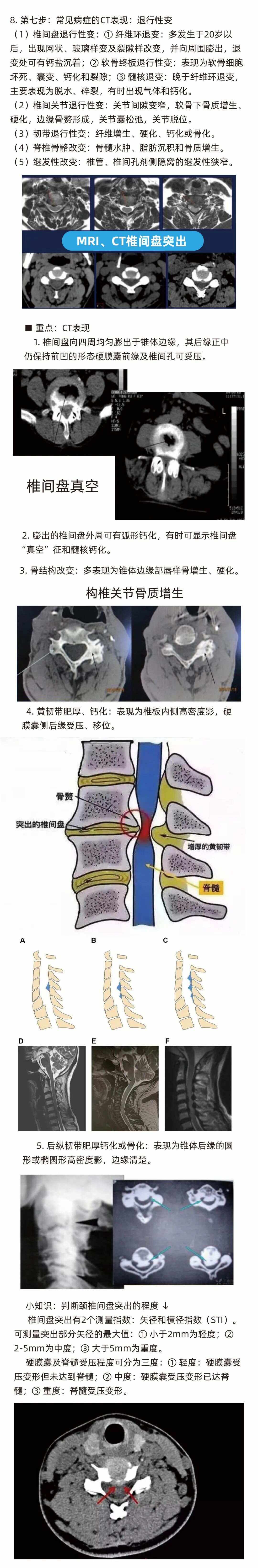 颈椎做CT还是磁共振好
