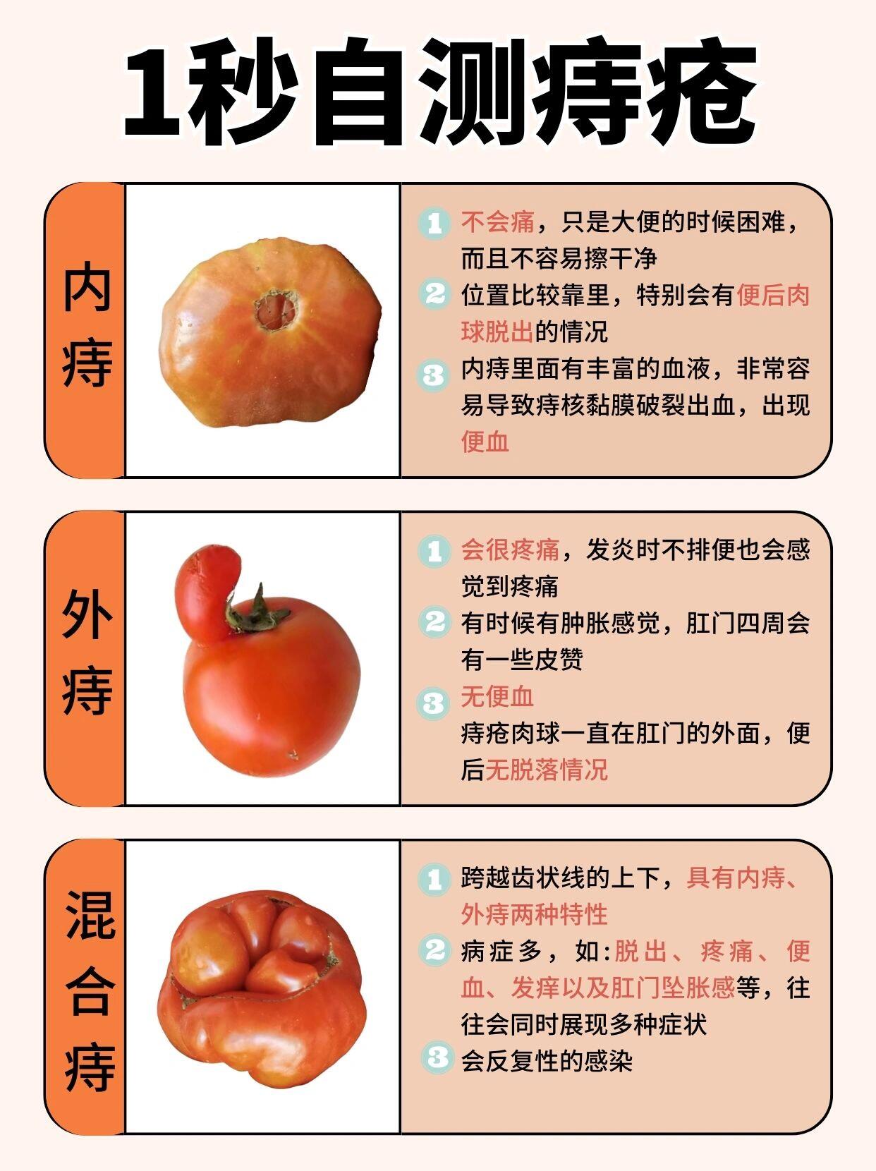 得了痔疮需要注意些什么