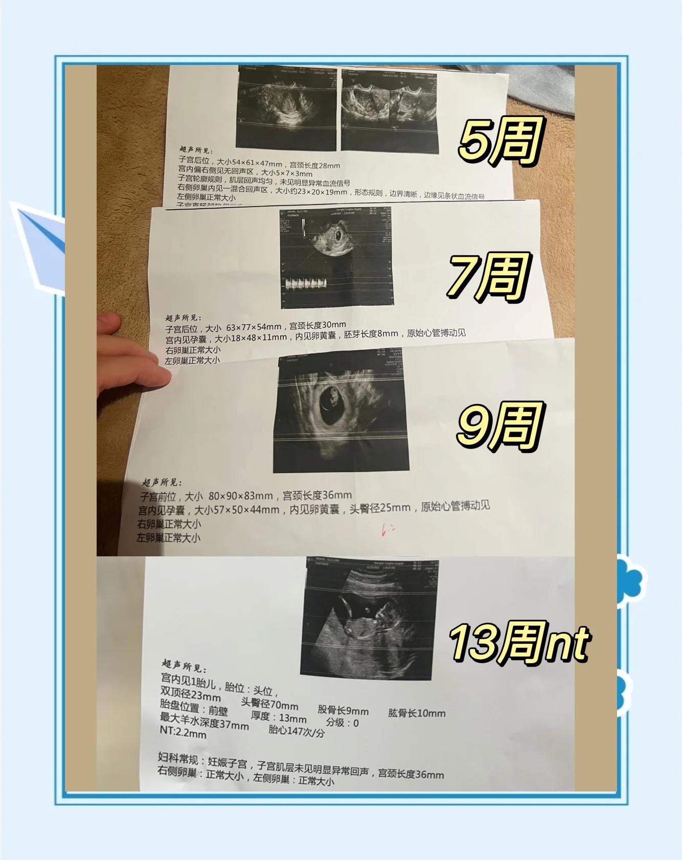 怀孕满三个月都要做什么检查