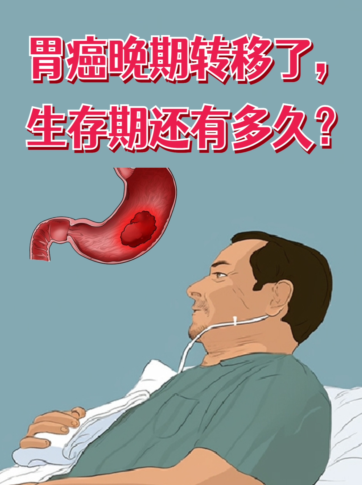 胃癌的晚期症状有哪些?