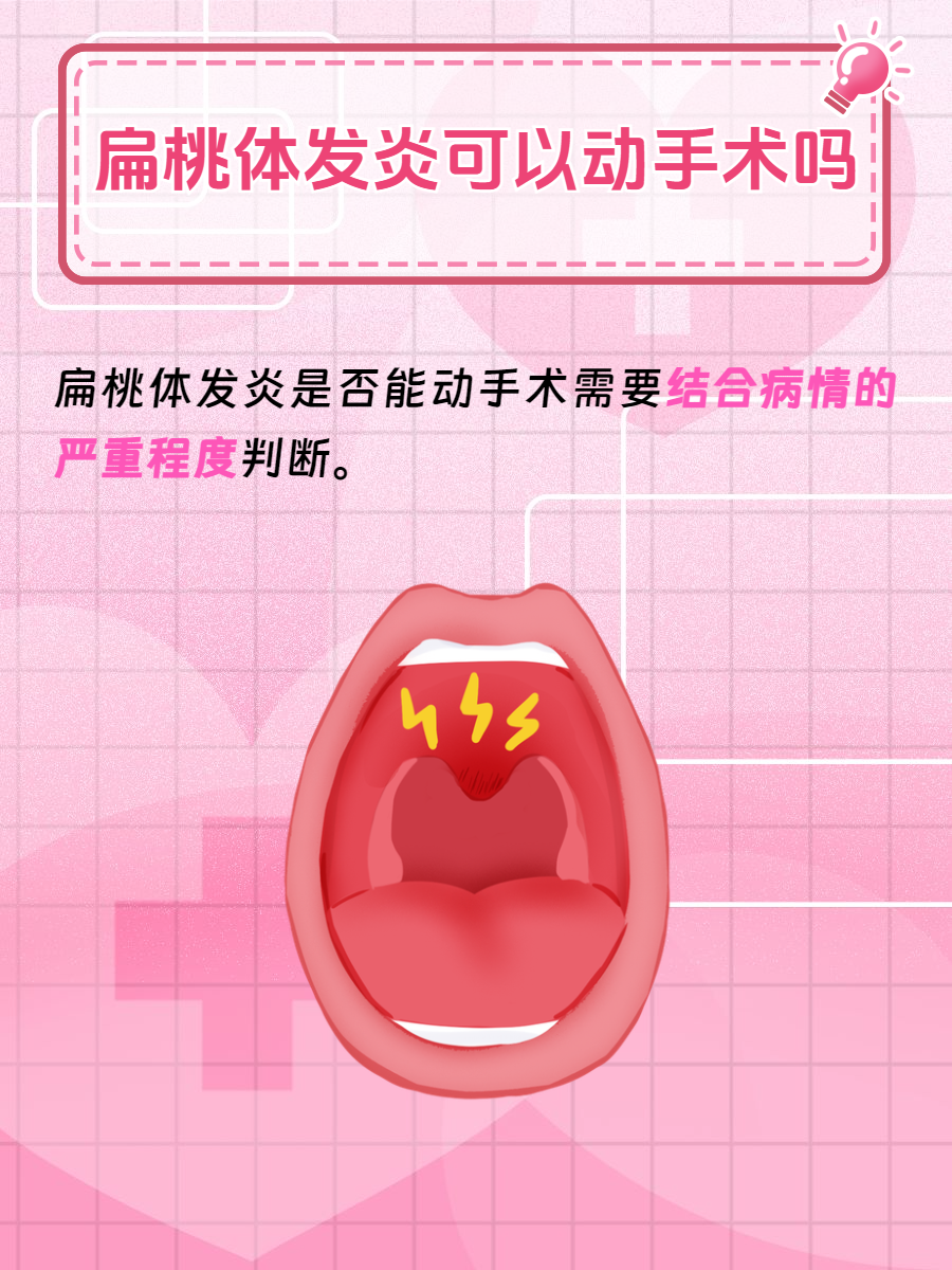 扁桃体发炎怎么办