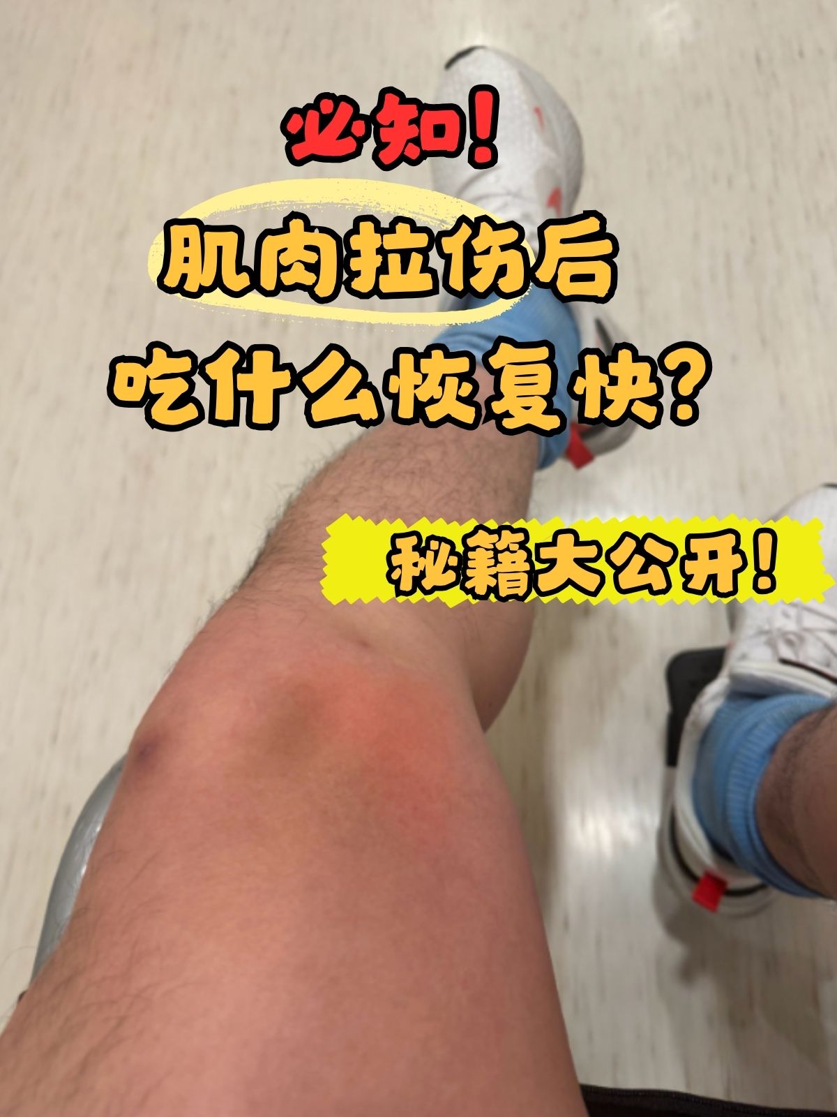 胳膊肌肉拉伤怎么治疗