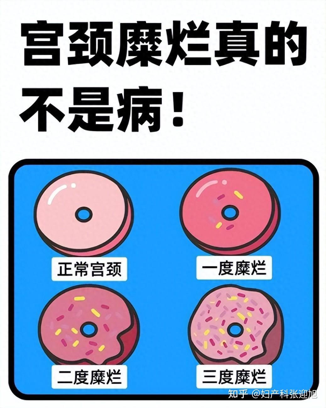 宫颈糜烂小腹会疼吗