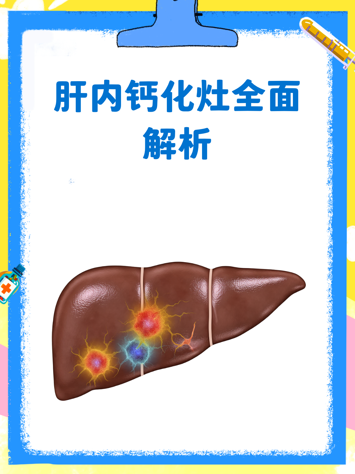 肝内钙化点影响当兵吗?