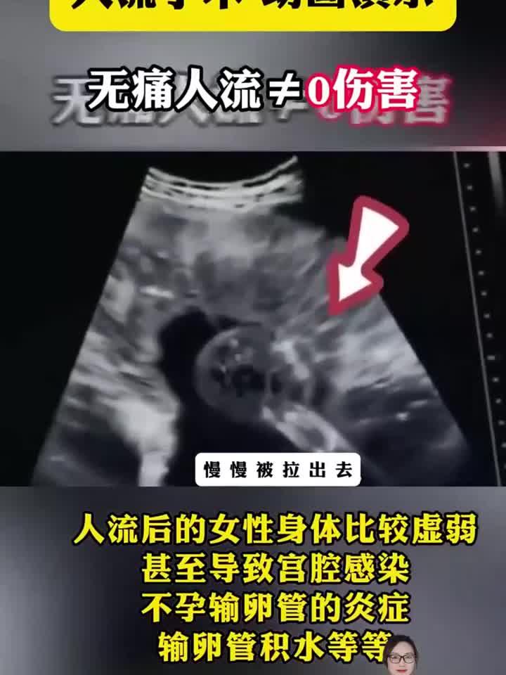 人流的整个过程