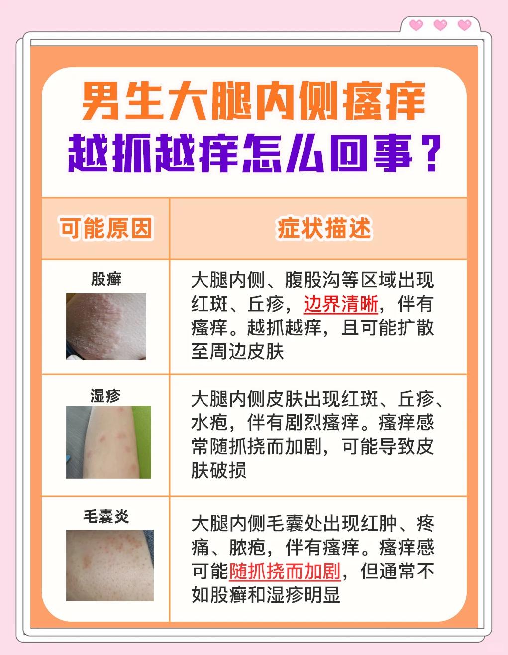 大腿内侧长疙瘩怎么办?