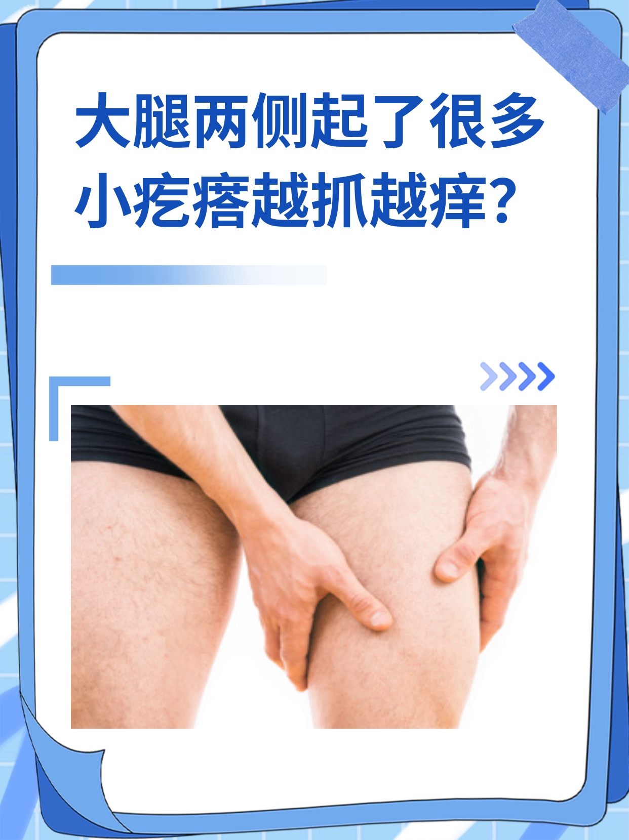 大腿内侧长疙瘩怎么办?