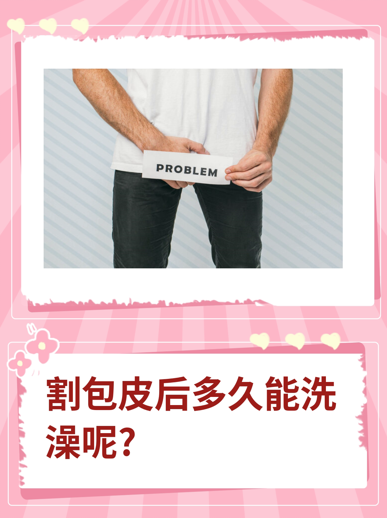 包皮手术后多久可以拆纱布?