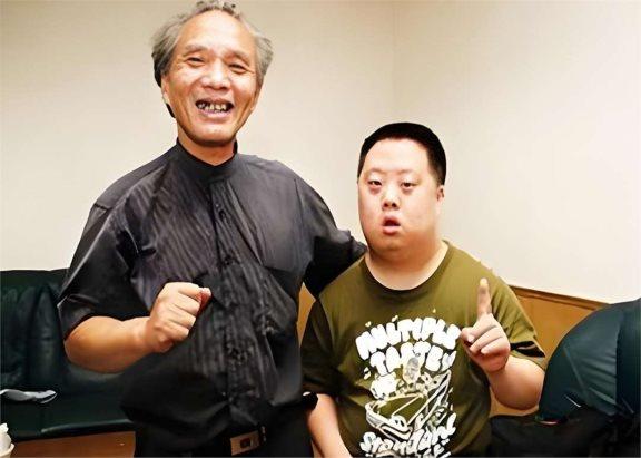 唐氏综合症能治好吗