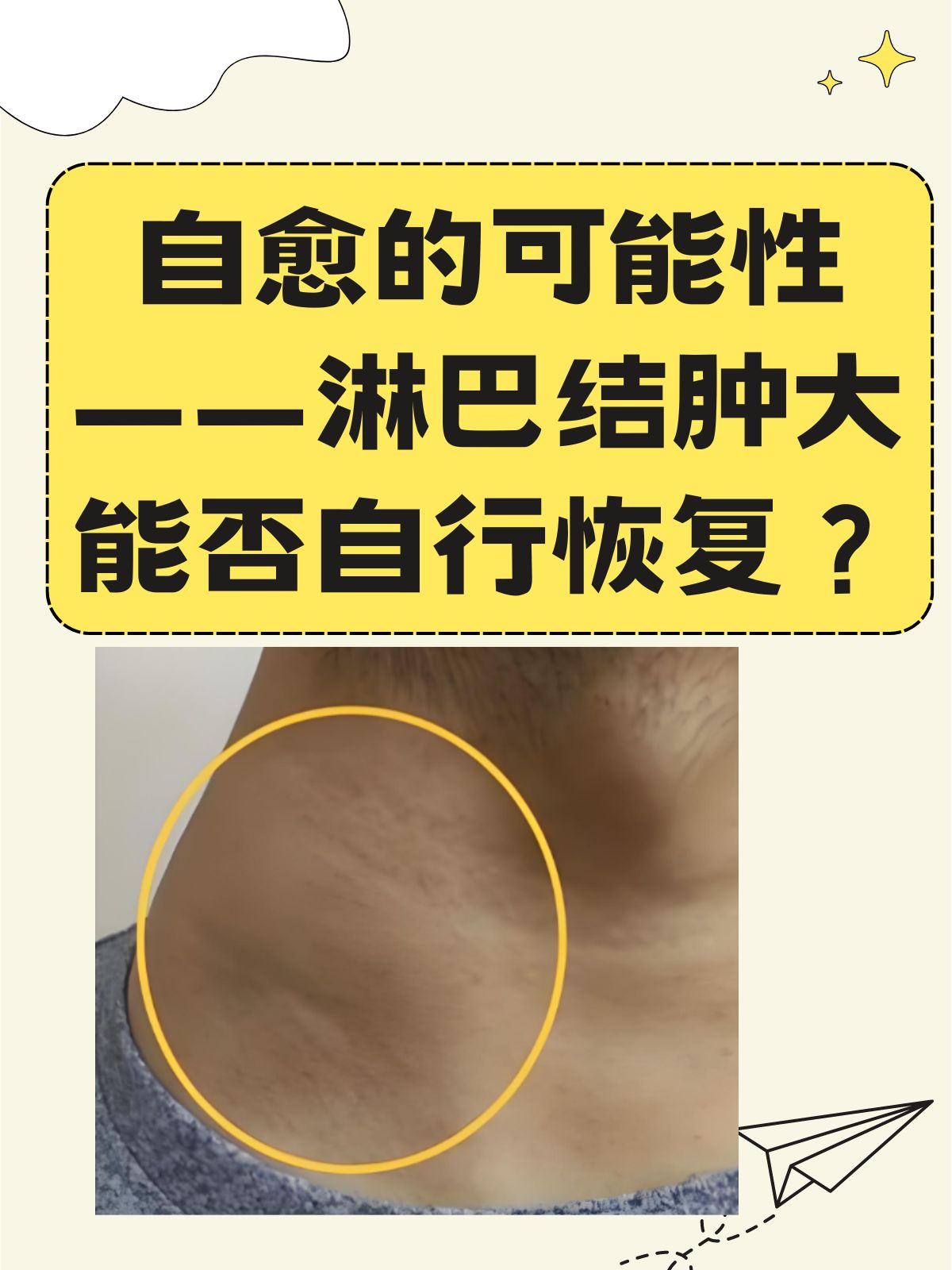 急性淋巴白血病的前兆