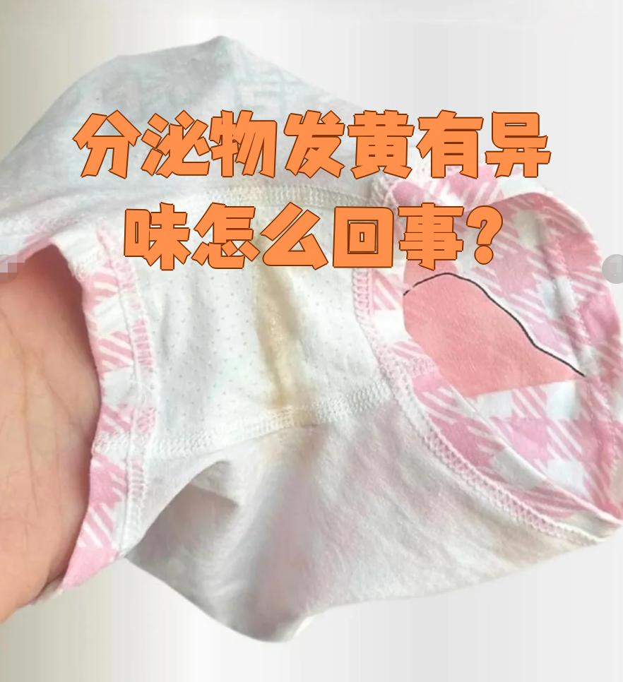 白带发黄无异味要紧吗