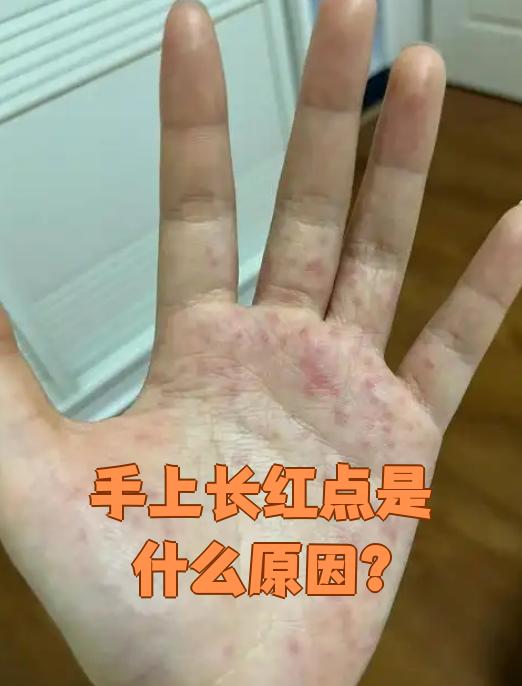 手上起小红点怎么回事