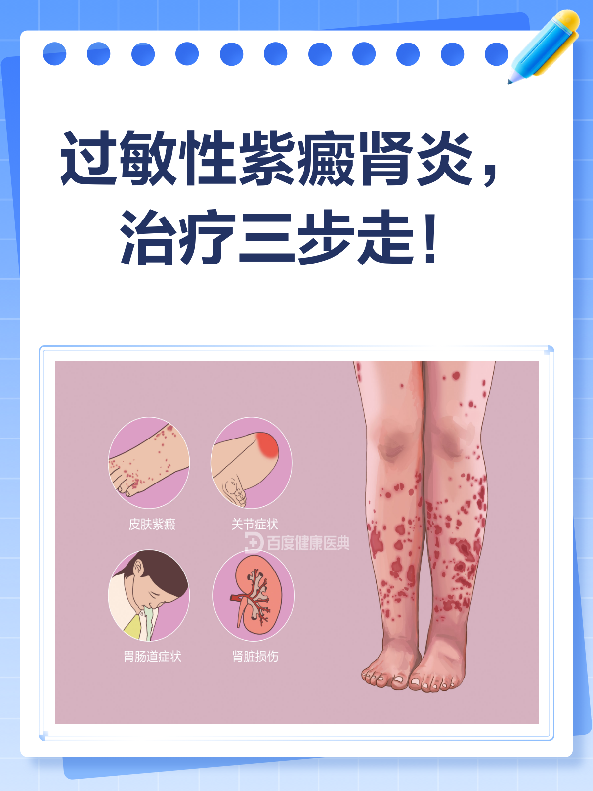 过敏性紫癜怎么医治,