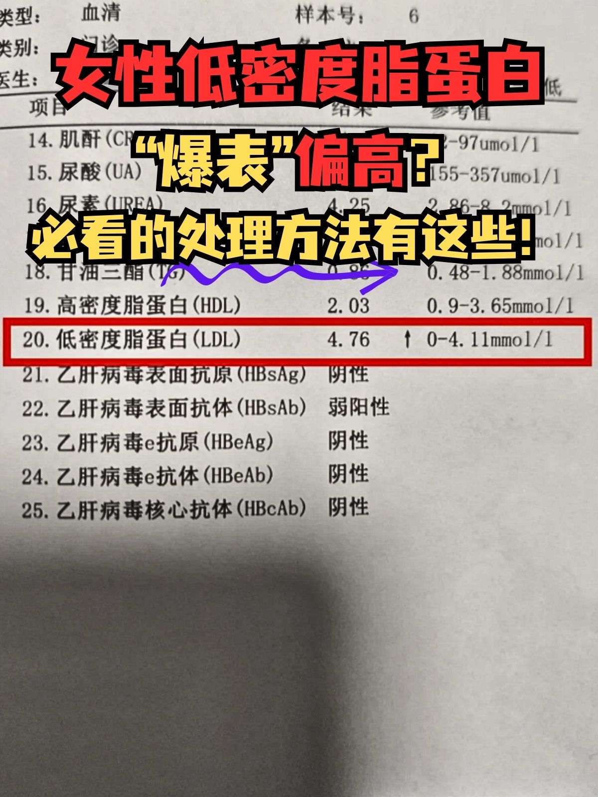 胆固醇偏低是什么意思