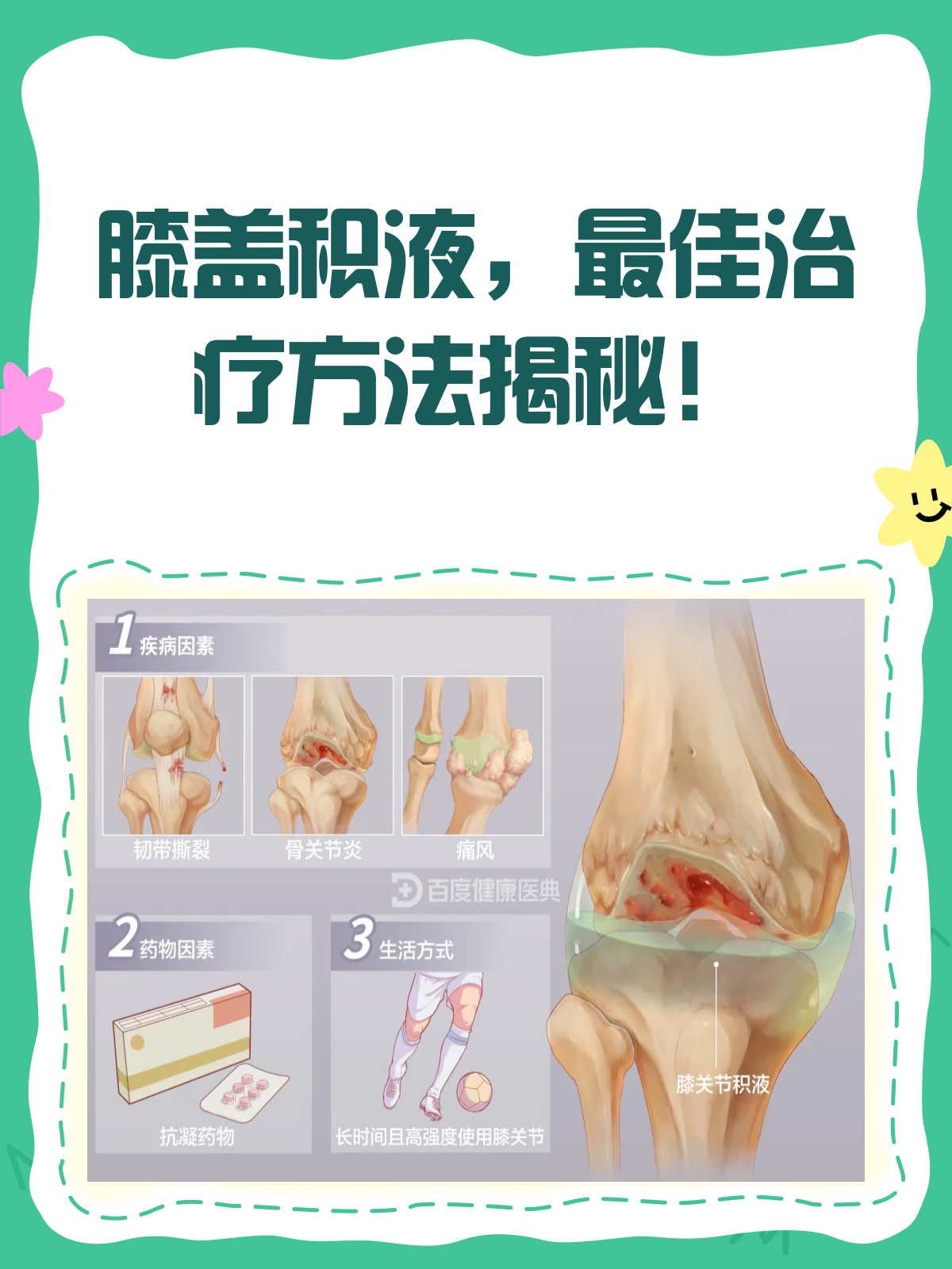 膝盖关节炎治疗方法有哪些?