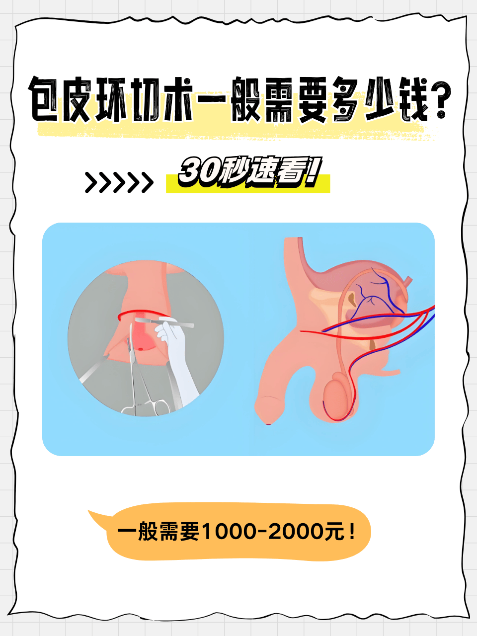 包皮阻复环副作用