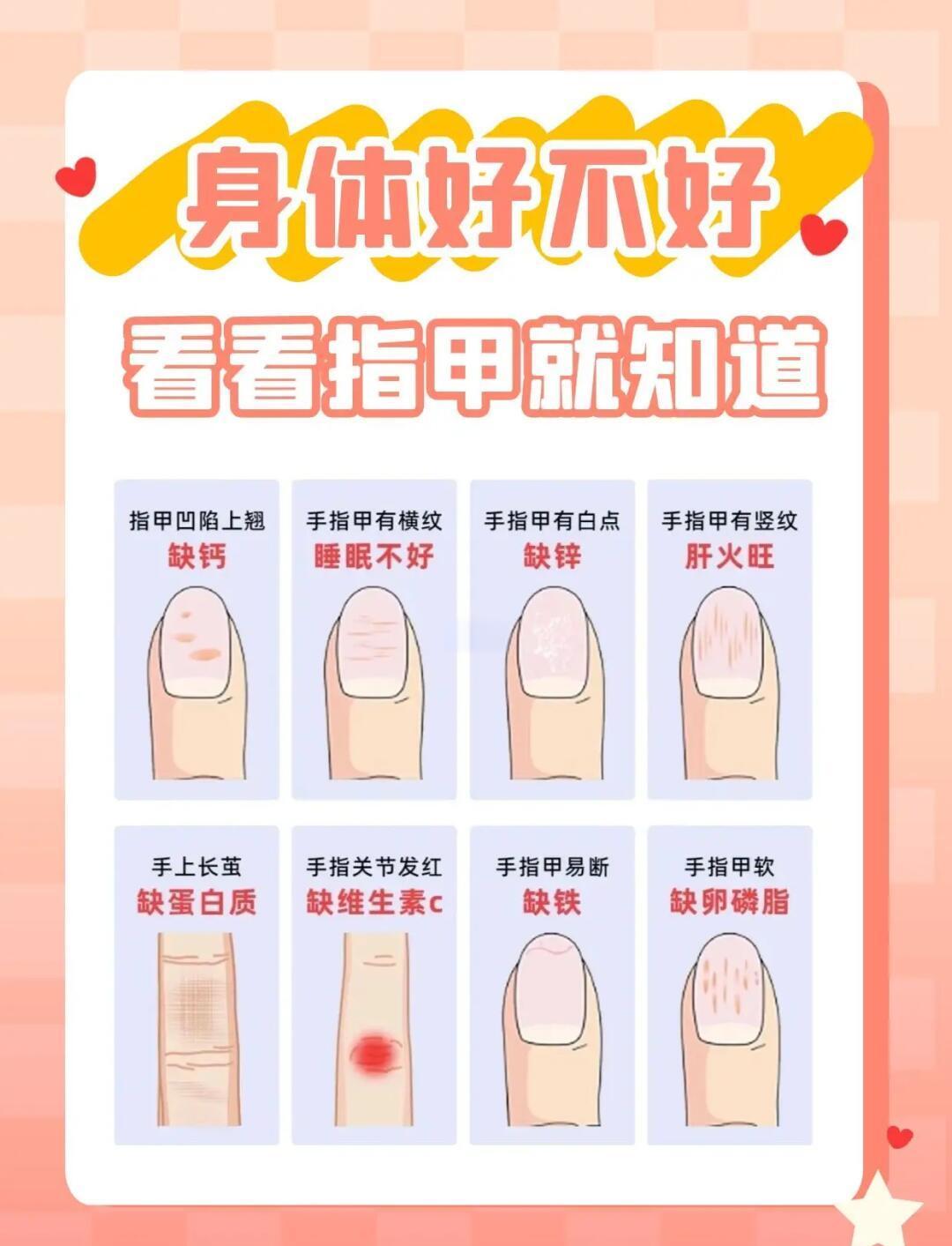 脚趾甲有横纹是怎么回事?