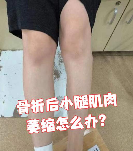 小腿肌肉萎缩怎么办
