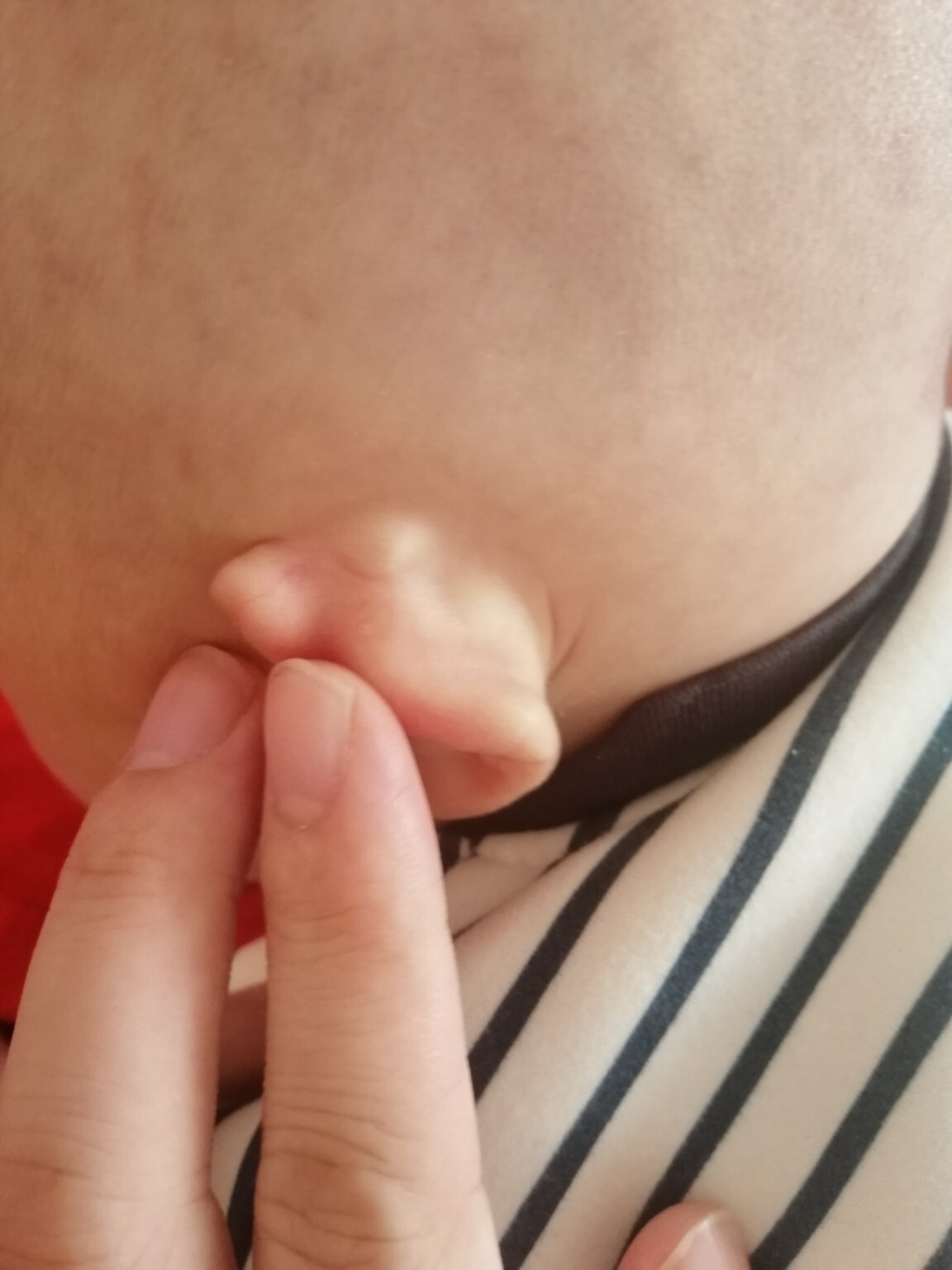 耳朵后面鼓了个包一摁就疼