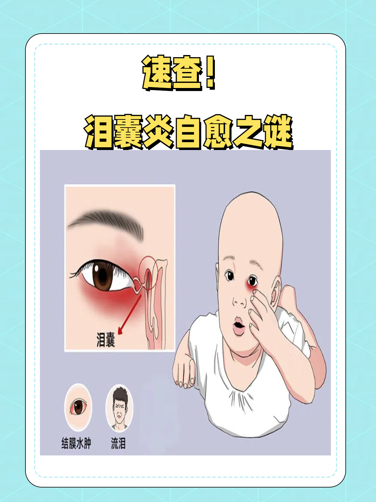 感冒时流眼泪,怎么治