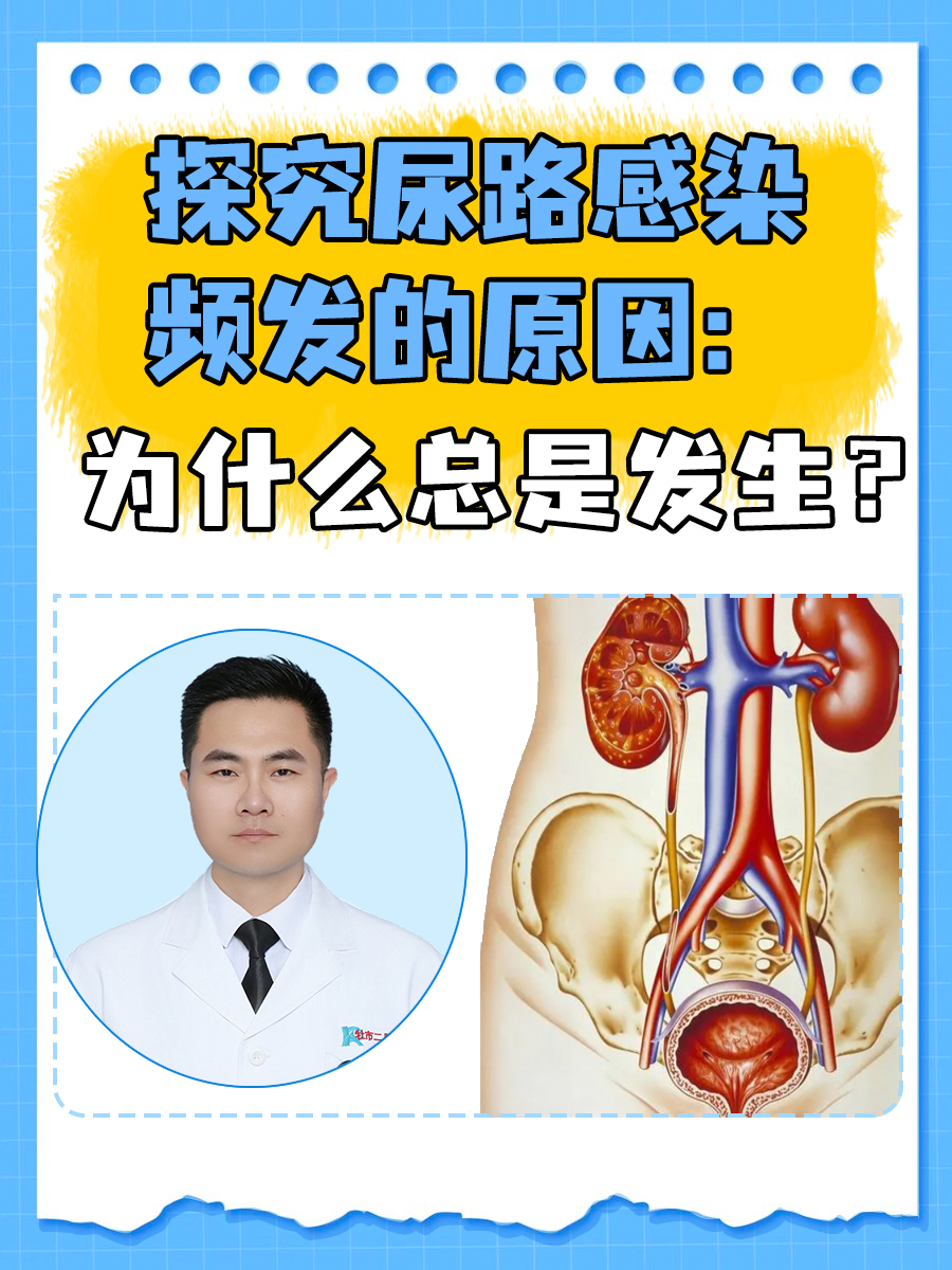 小便很频繁,是怎么回事?