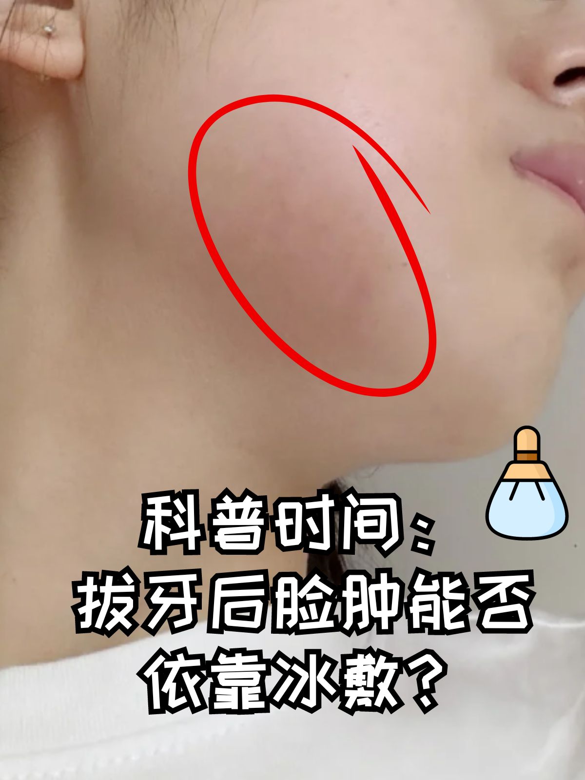 牙疼肿了半边脸怎么办