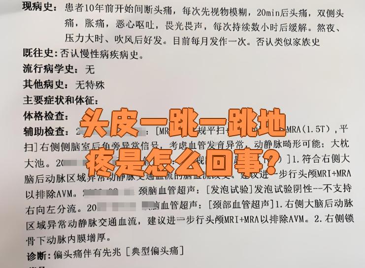头痛一阵一阵的跳着痛是怎么回事?