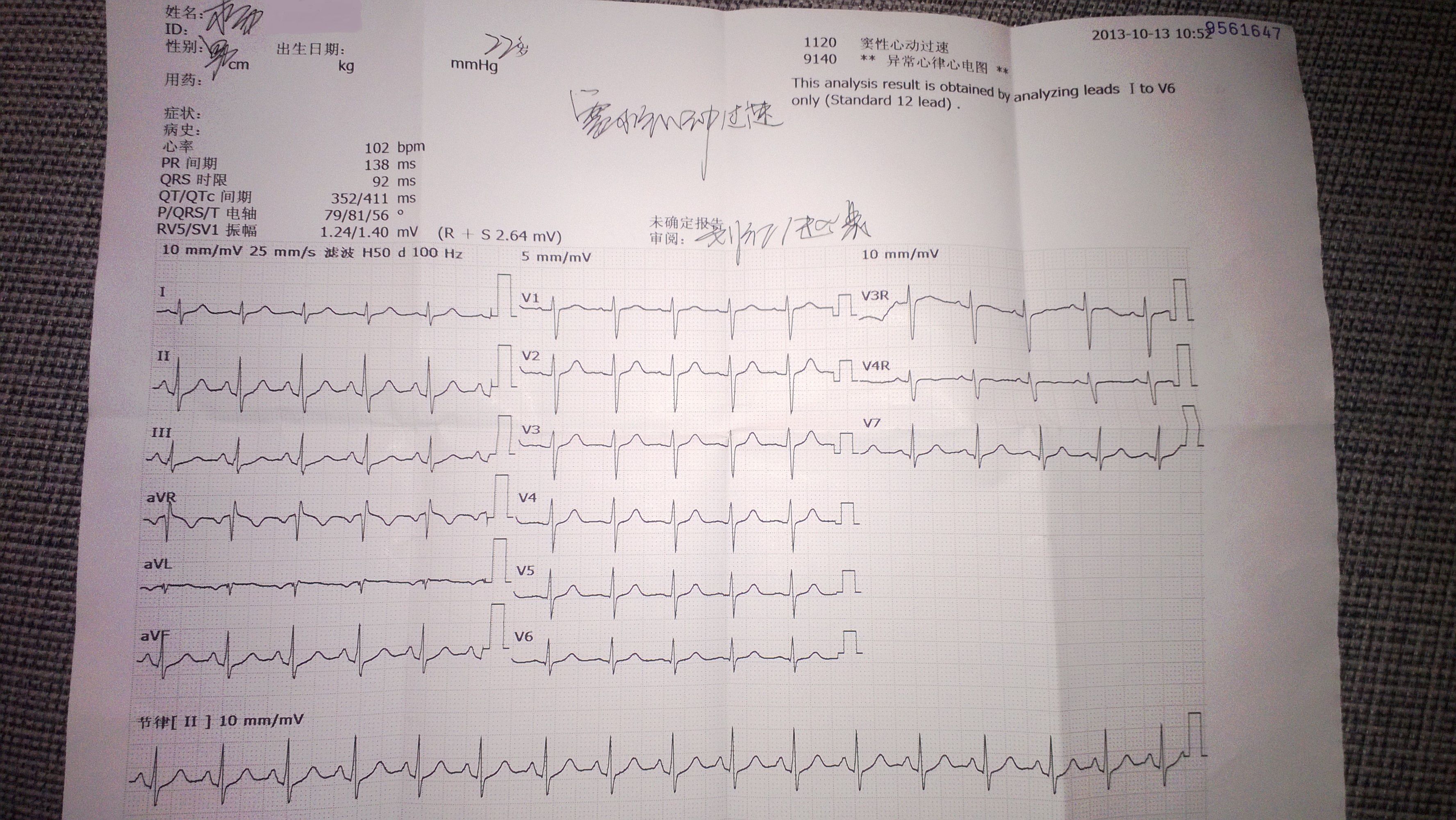 窦性心跳过速严重吗。