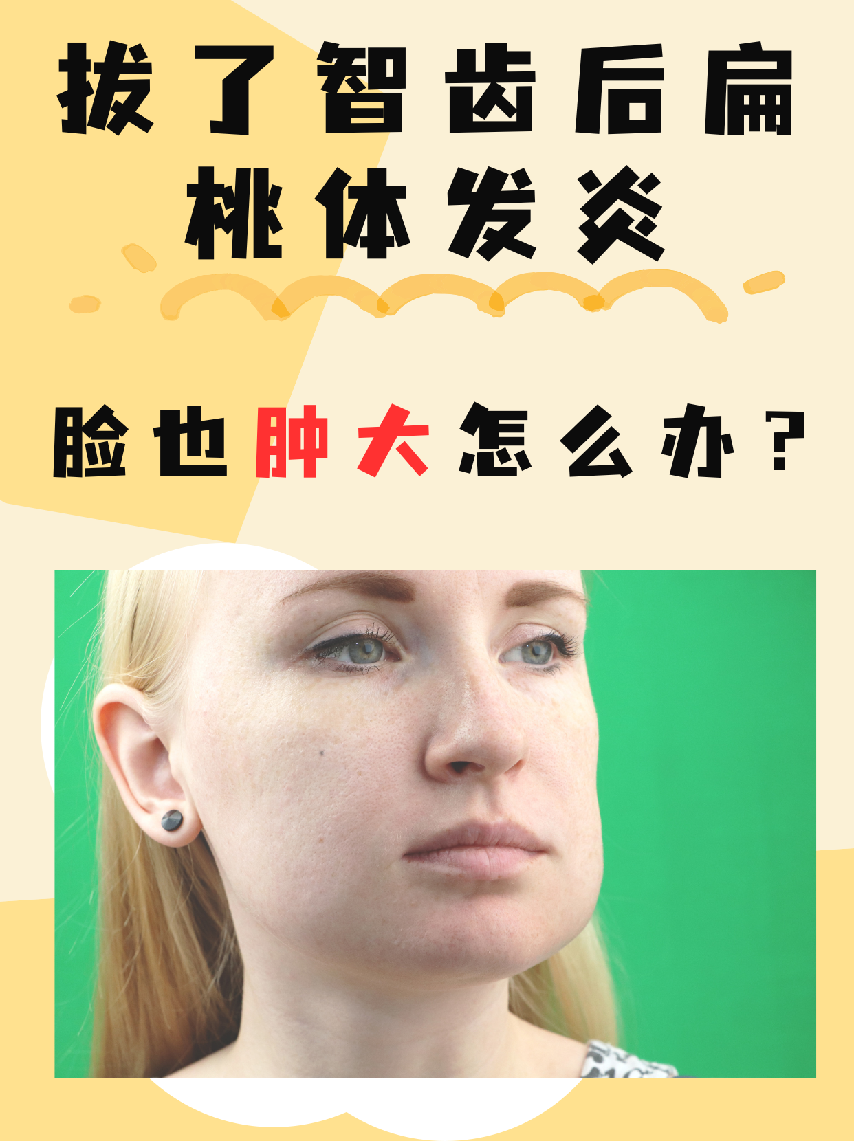 扁导体发炎肿大怎么办