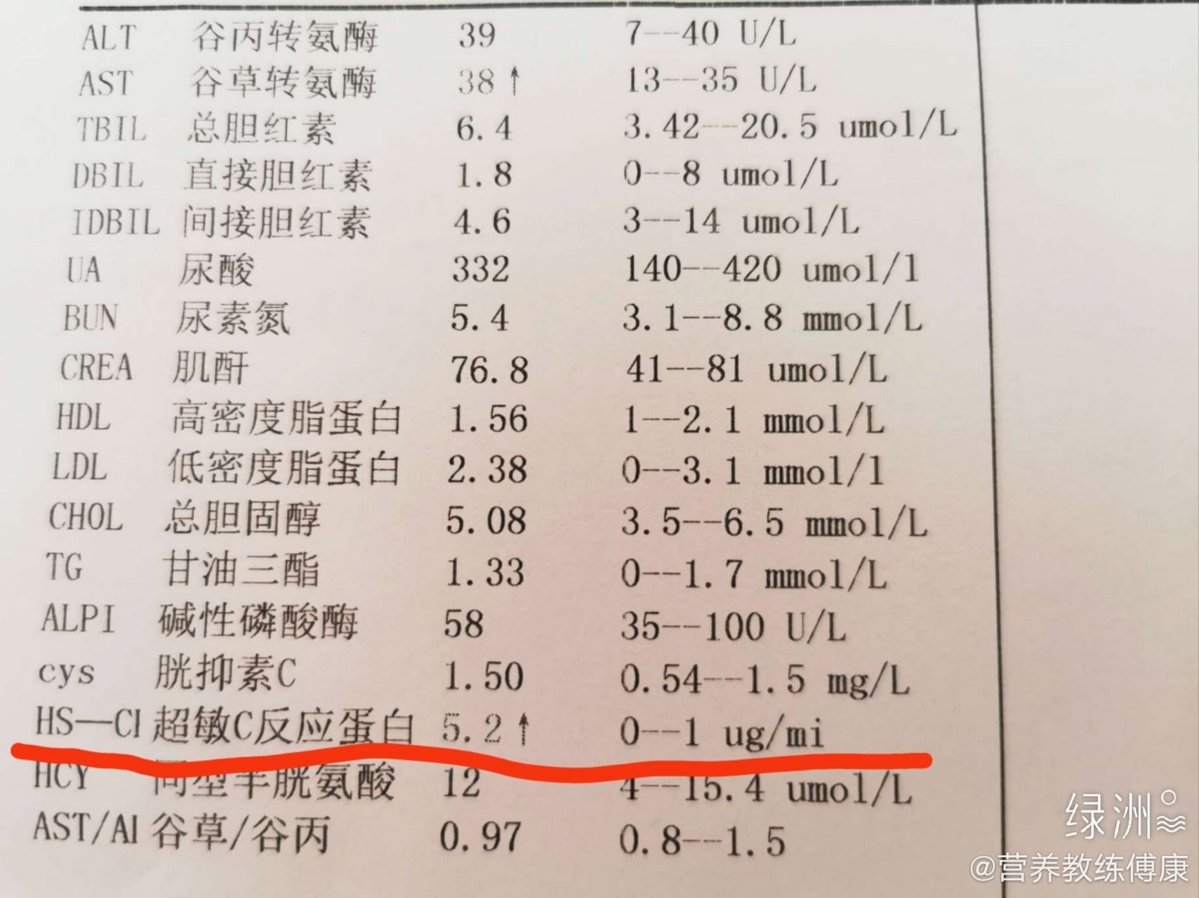C反应蛋白高说明什么