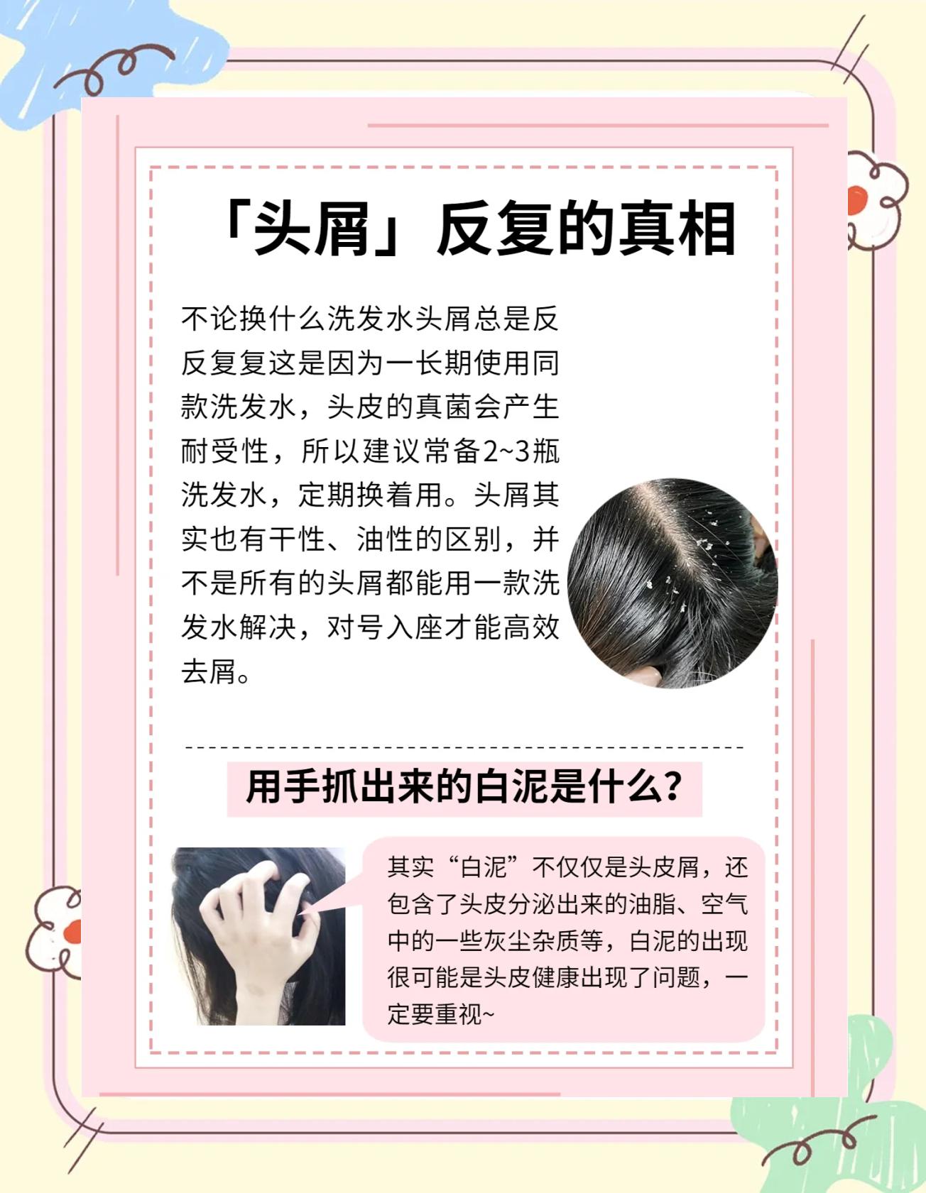 头皮痒,头屑多,怎么办.