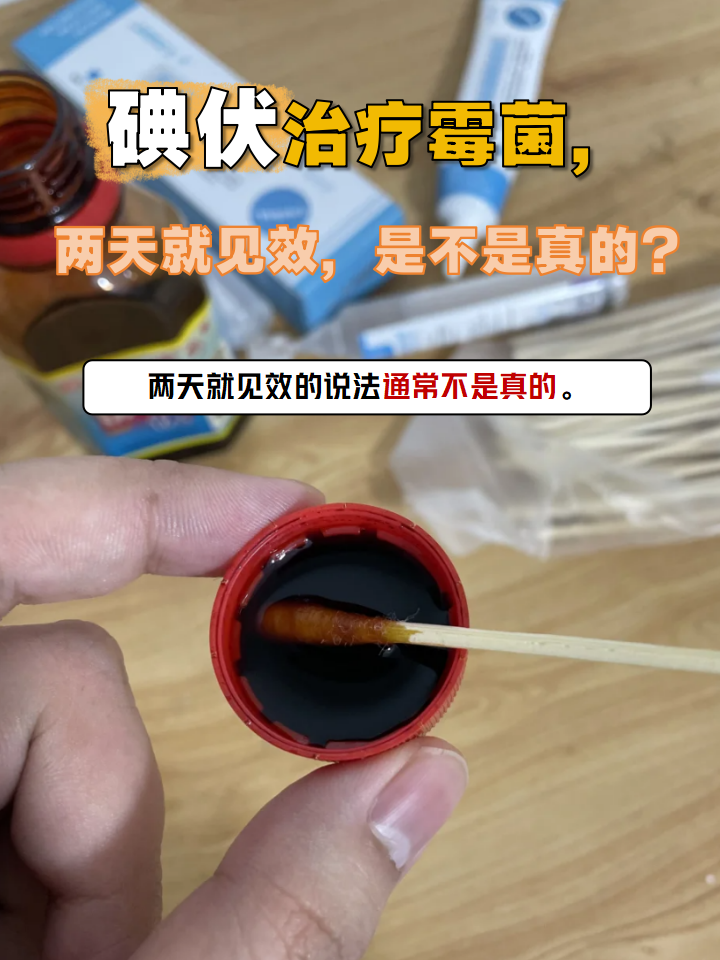 霉菌感染如何治疗