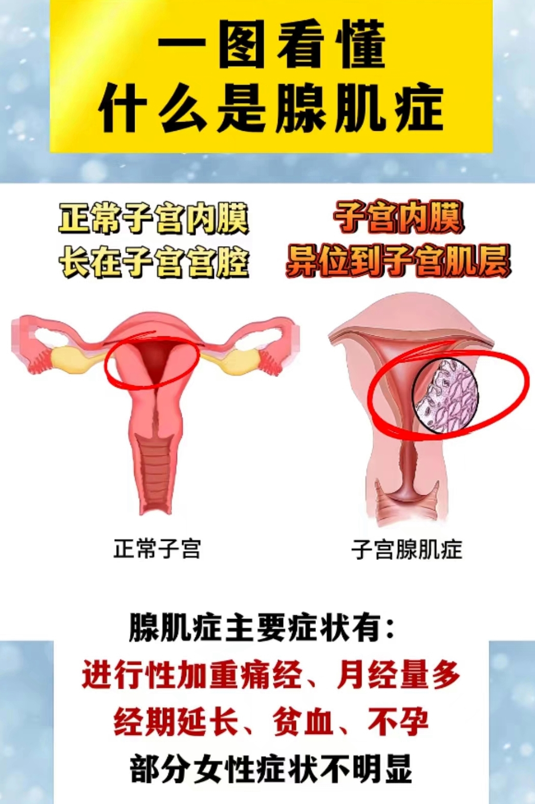 子宫腺肌症怎么治疗最好