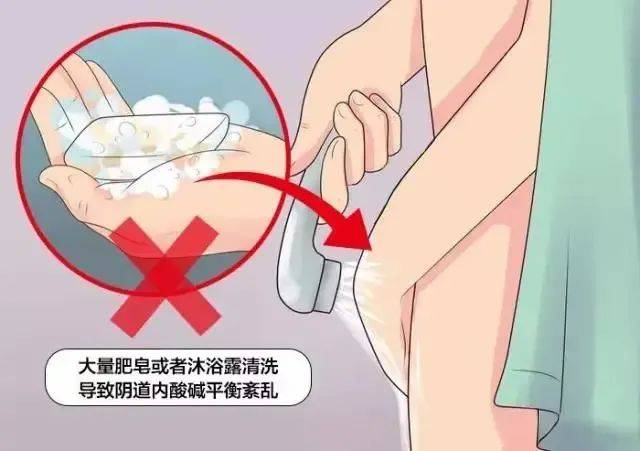 细菌性阴炎怎么得的