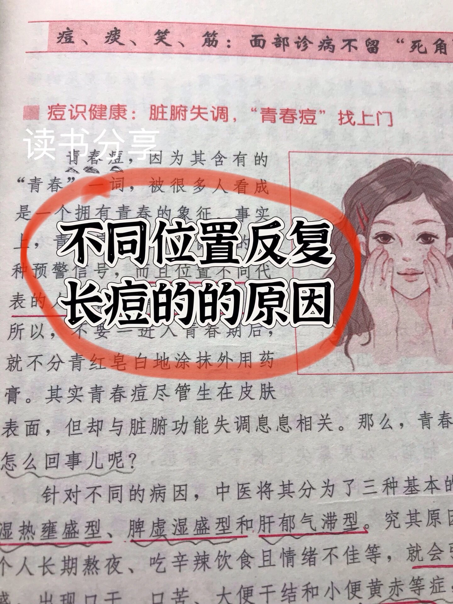 脸上长痤疮的原因是什么