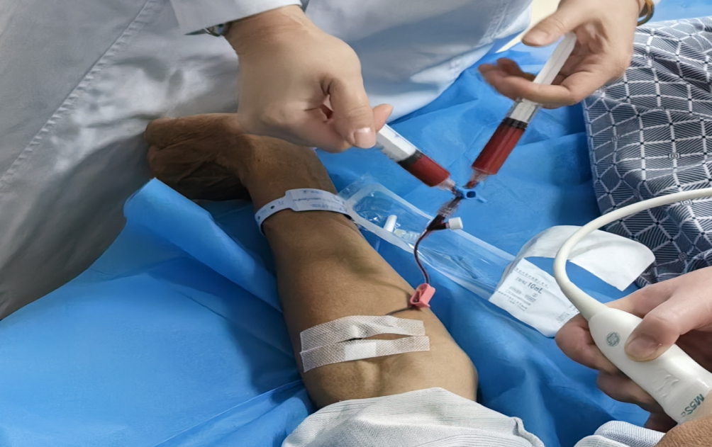 心血管造影检查怎么做