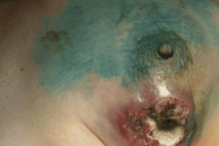 羊水破了的症状