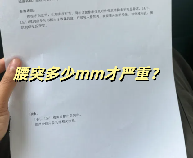 腰椎间盘突出严重吗