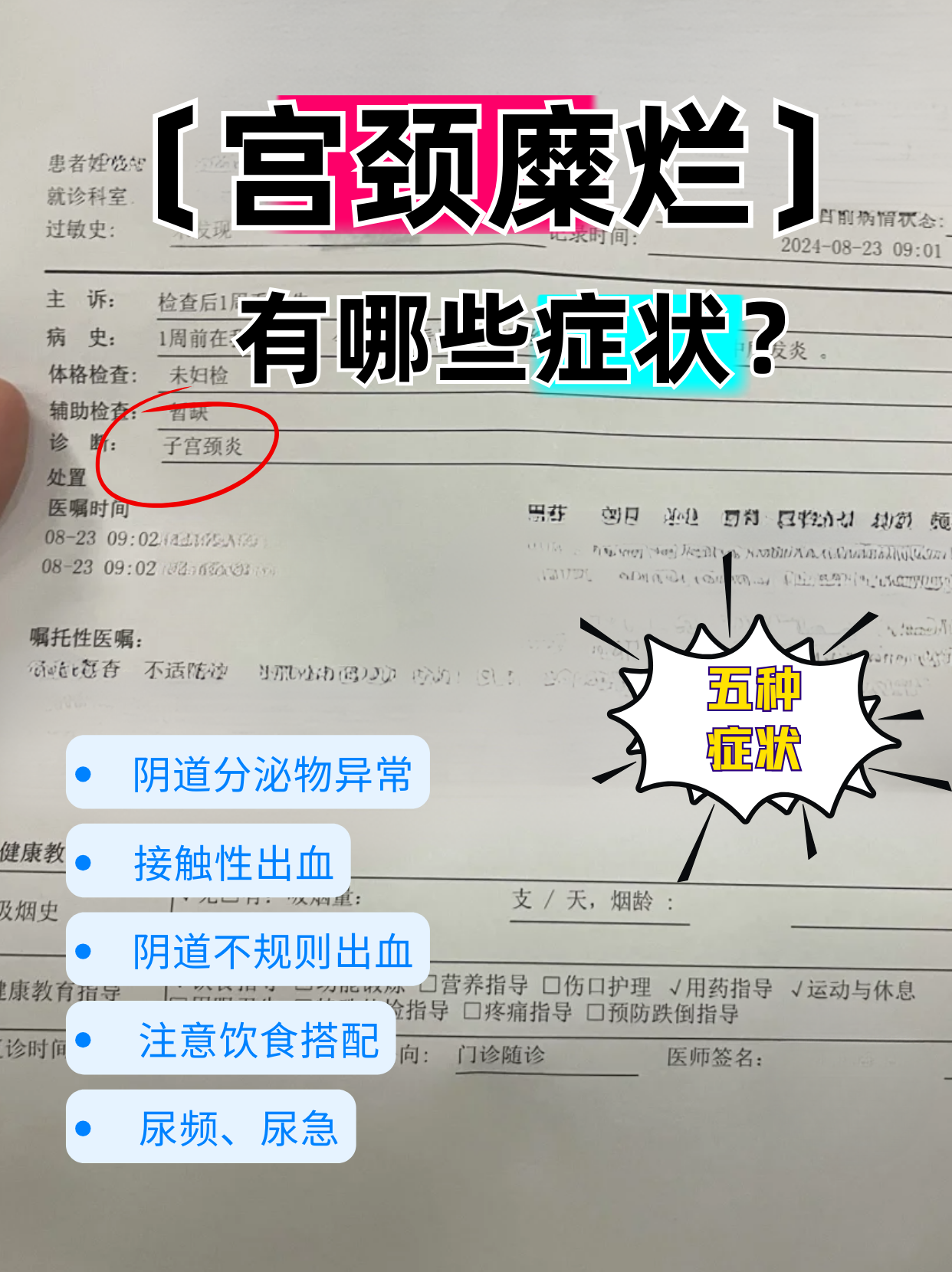 宫颈糜烂早期症状