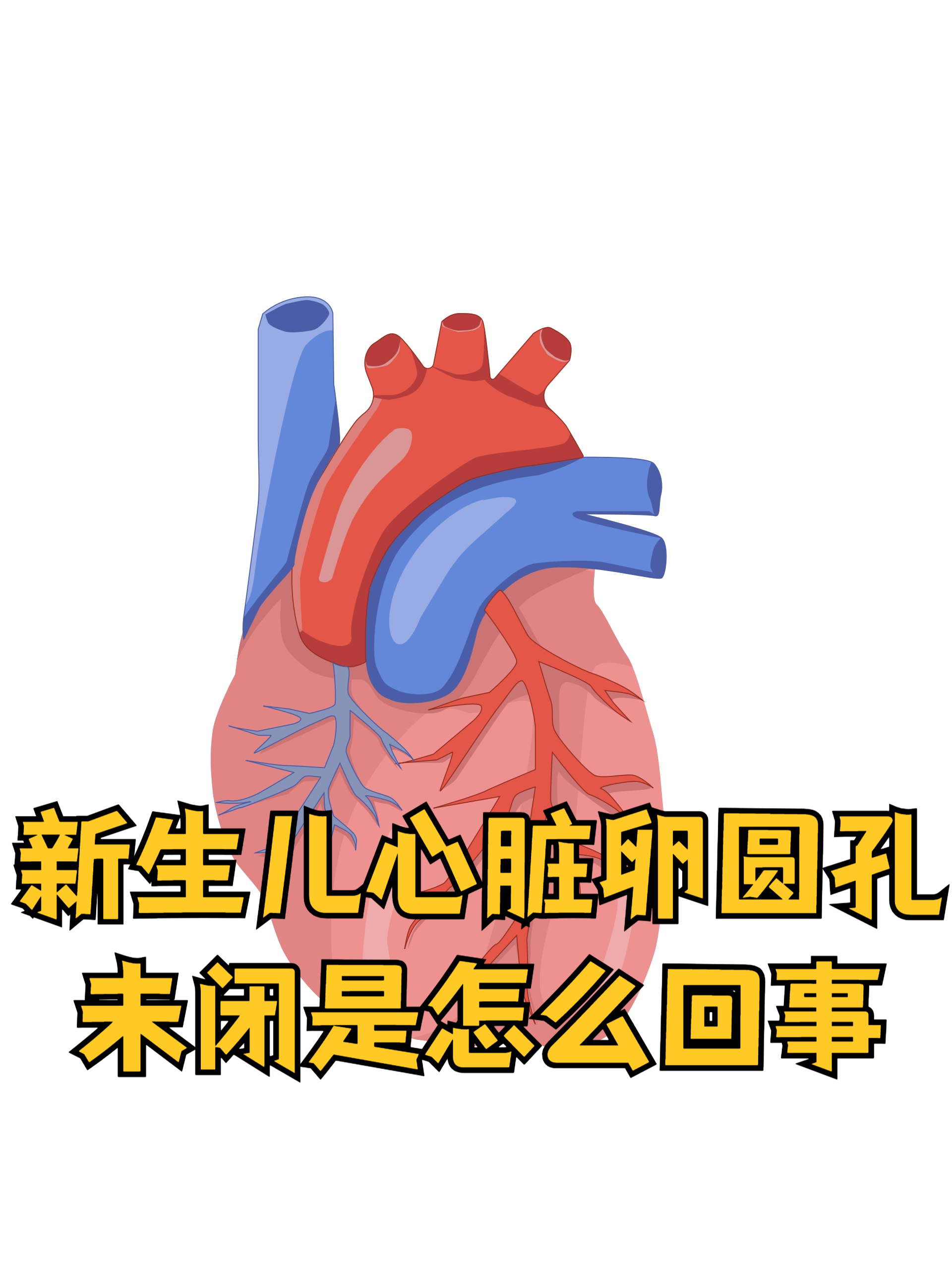 卵圆孔未闭2mm严重吗
