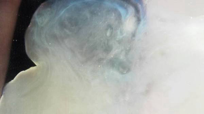 精子透明像水一样正常吗