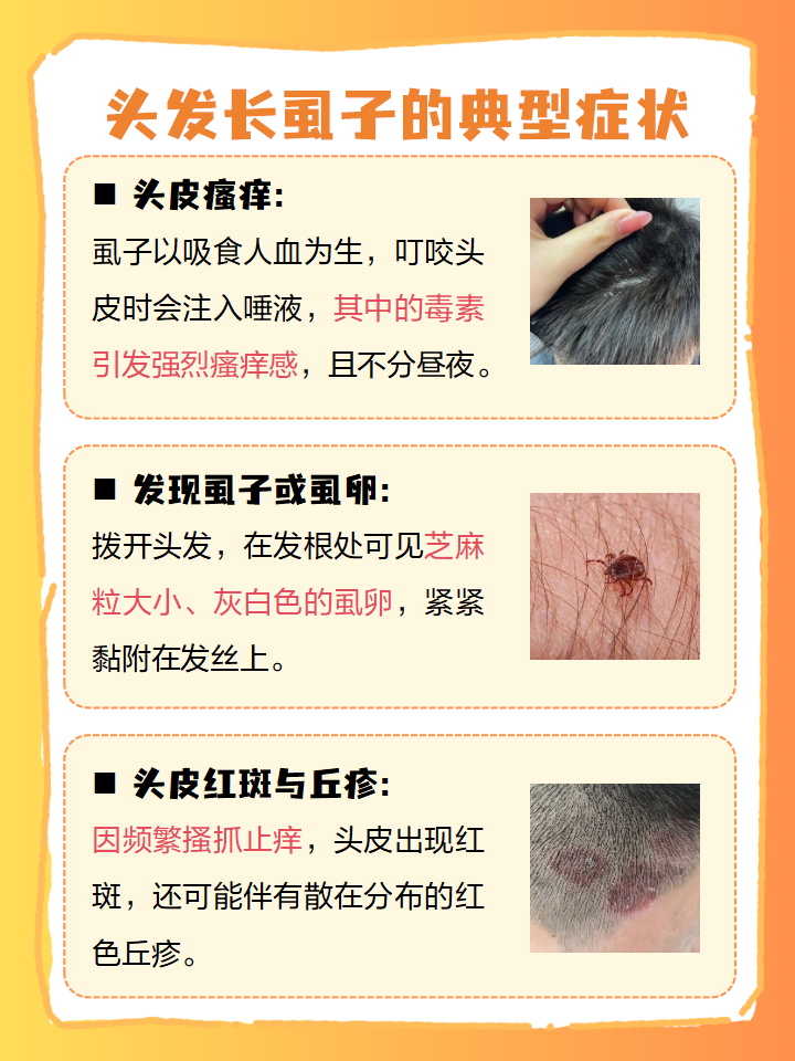 小孩头上长了虱子怎么办