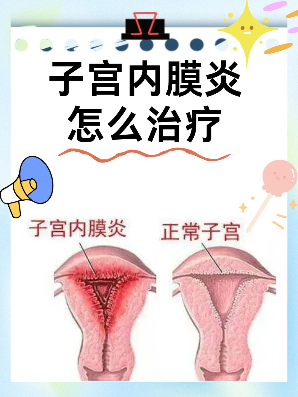 输卵管炎的症状