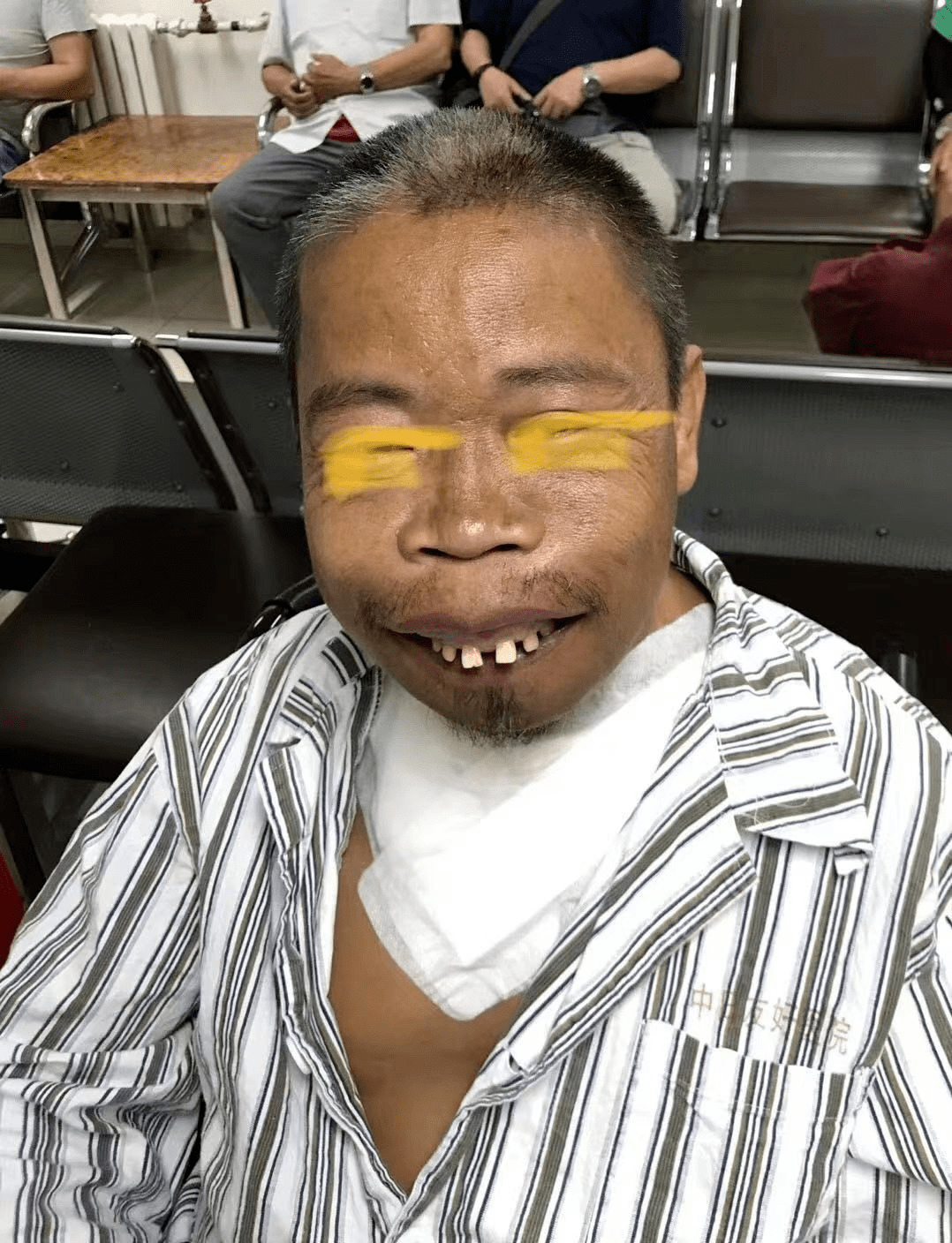 尿毒症早期症状有哪些