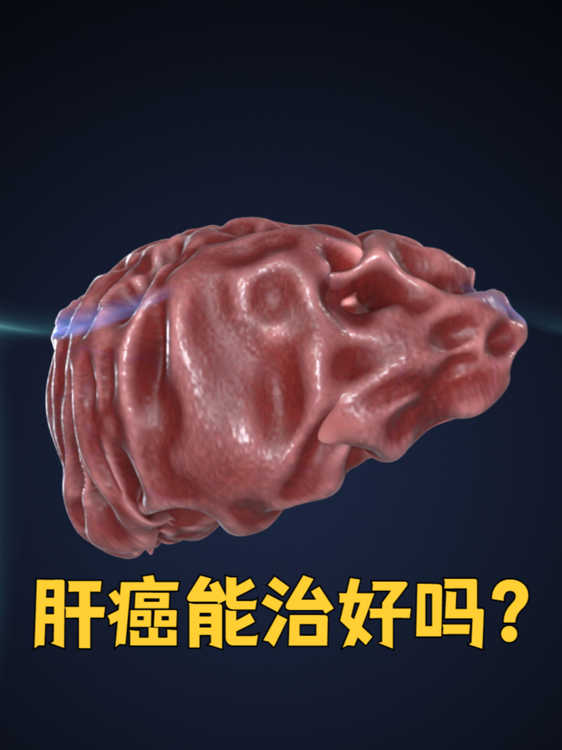 肝占位是肝癌吗