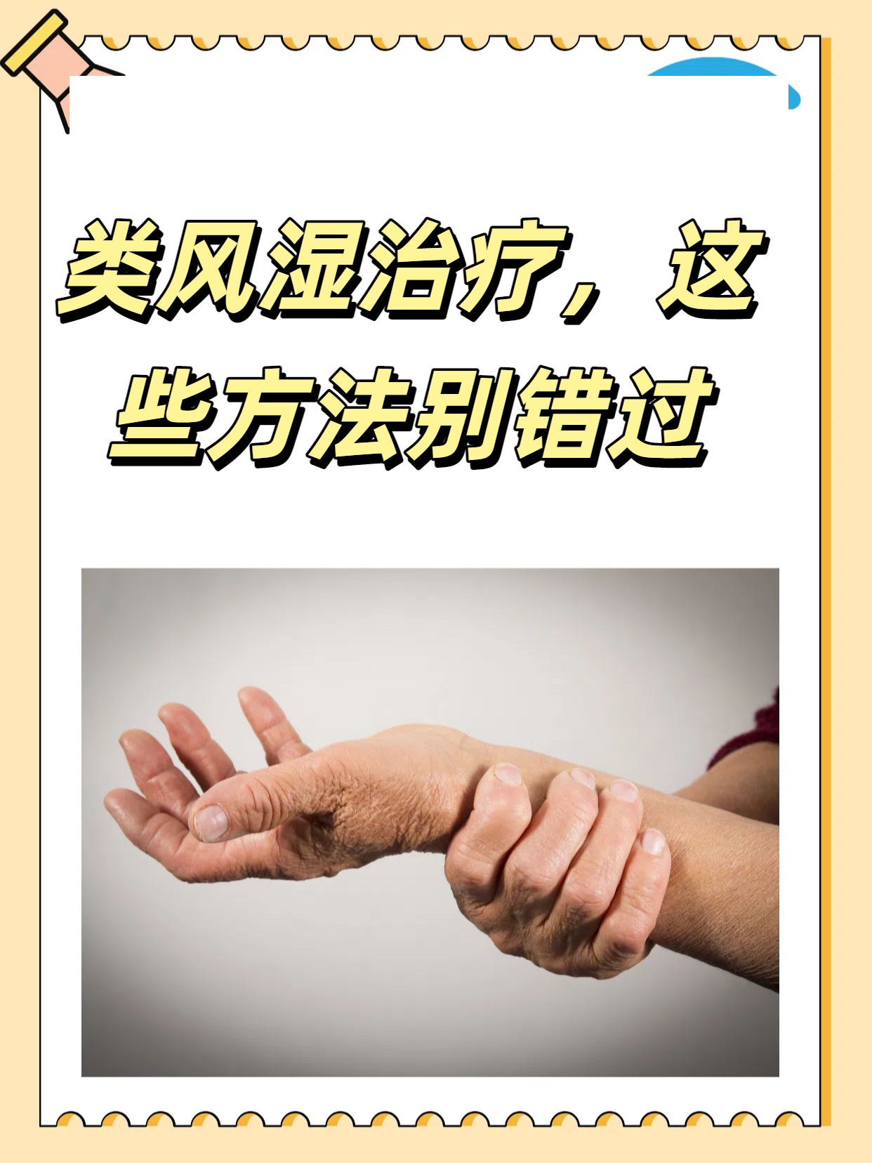 类风湿有什么治疗方法