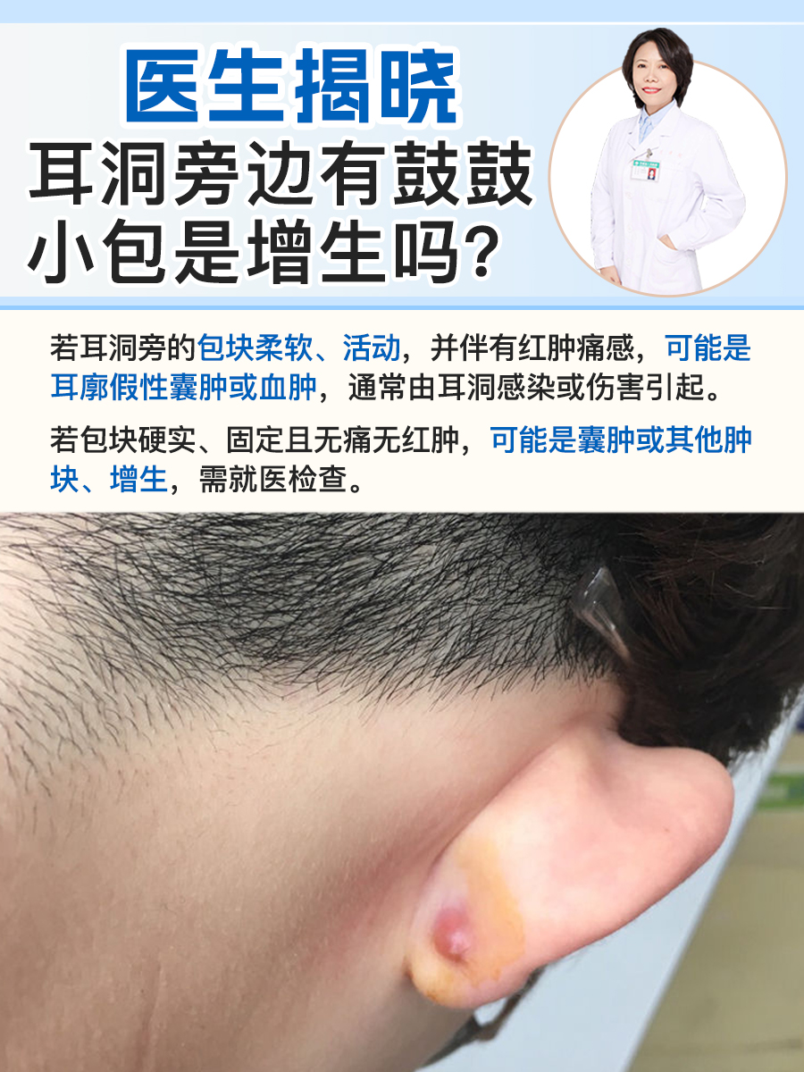 耳洞发炎流脓怎么办?