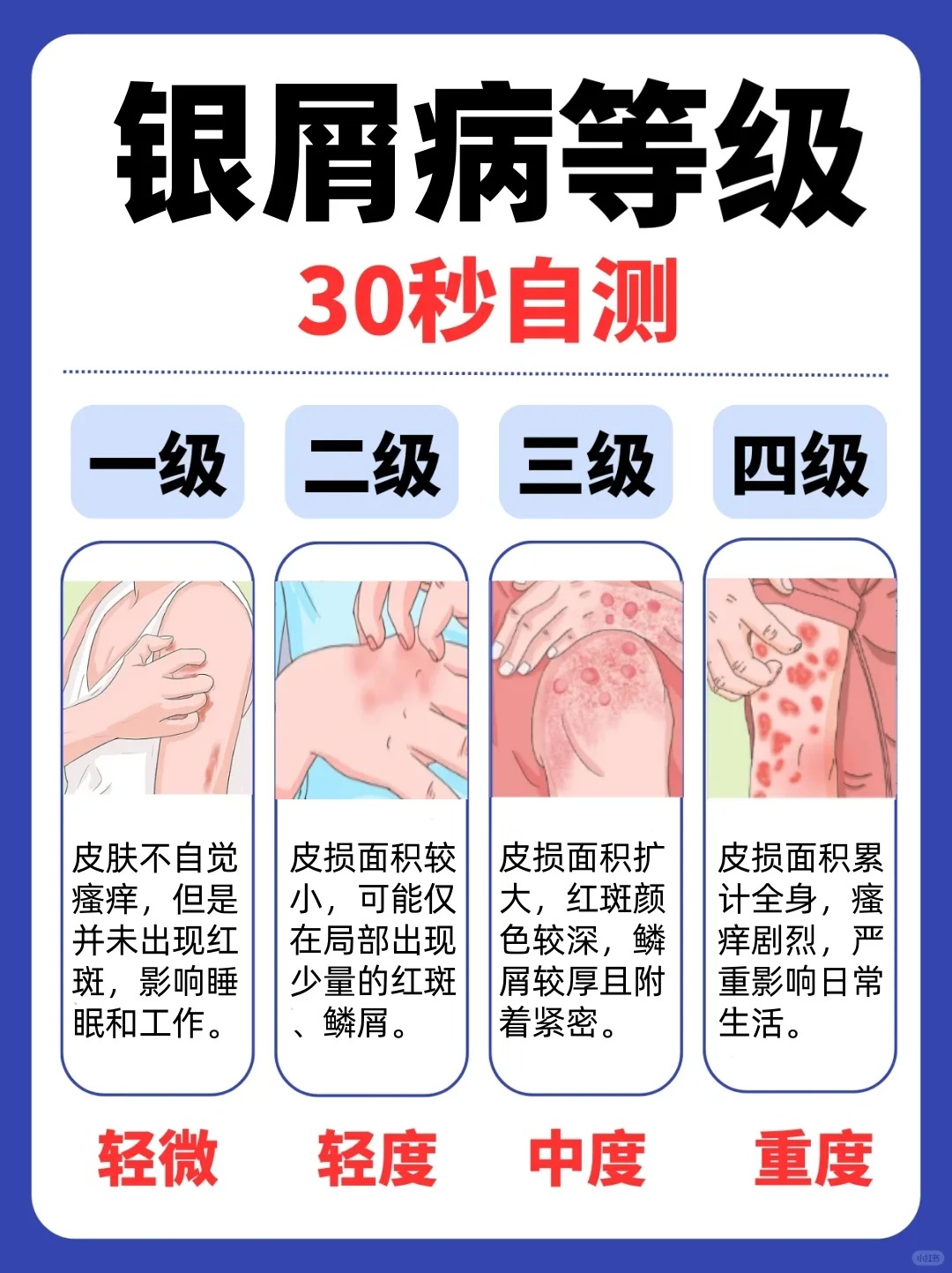 银屑病会传染吗?